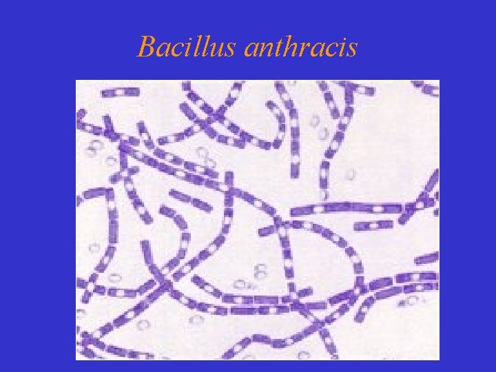 Bacillus anthracis 