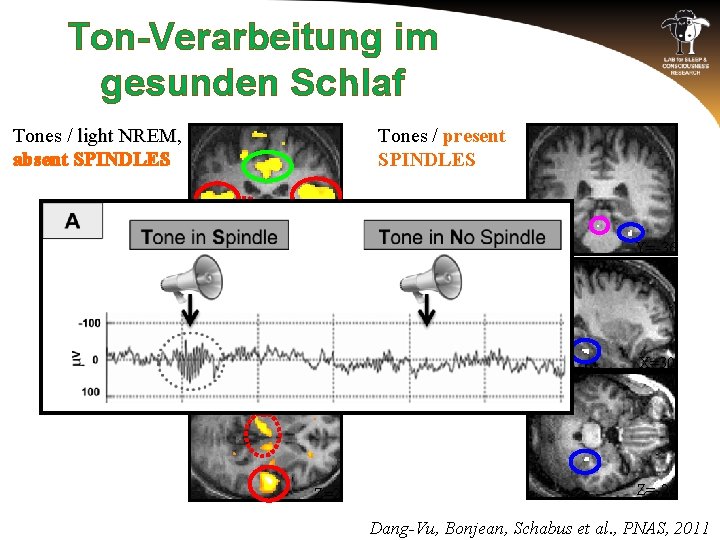 Ton-Verarbeitung im gesunden Schlaf Tones / light NREM, absent SPINDLES A 1 (red circles),