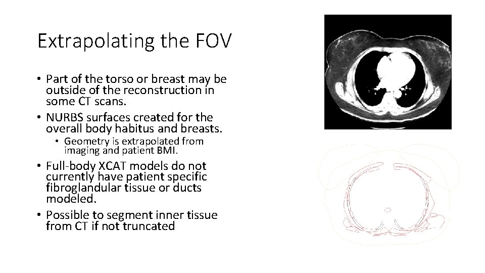 Extrapolating the FOV • Part of the torso or breast may be outside of