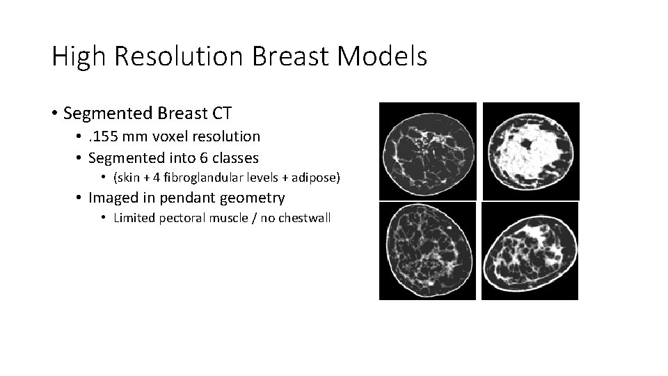High Resolution Breast Models • Segmented Breast CT • . 155 mm voxel resolution
