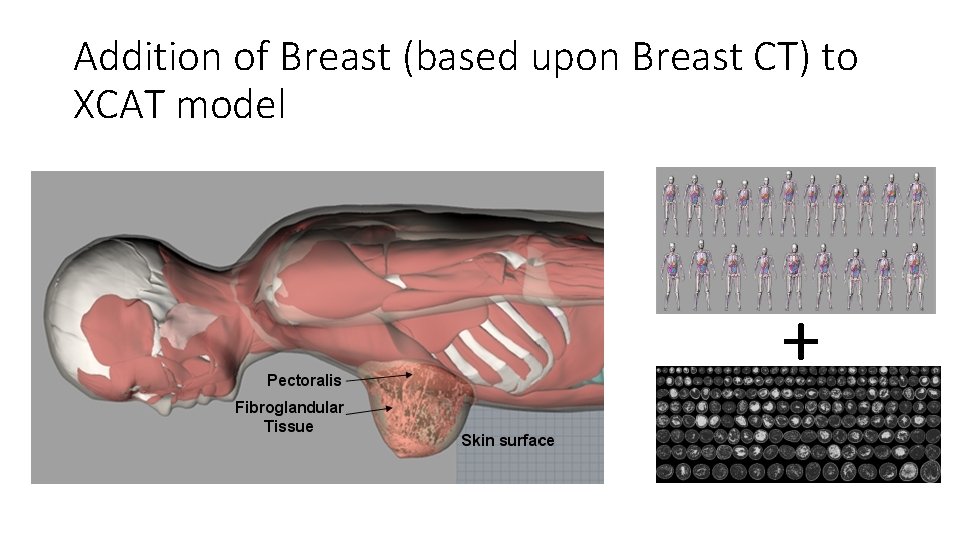 Addition of Breast (based upon Breast CT) to XCAT model + 