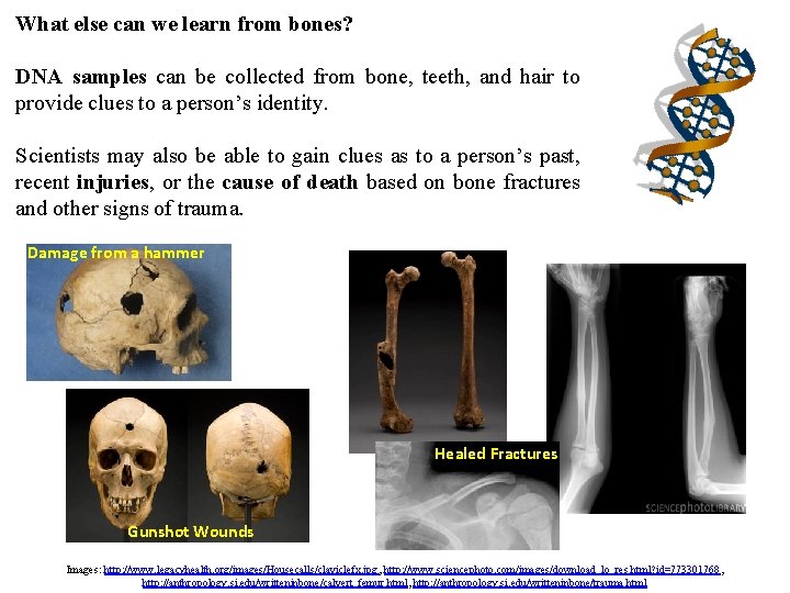 What else can we learn from bones? DNA samples can be collected from bone, What else can we learn from bones? DNA samples can be collected from bone,