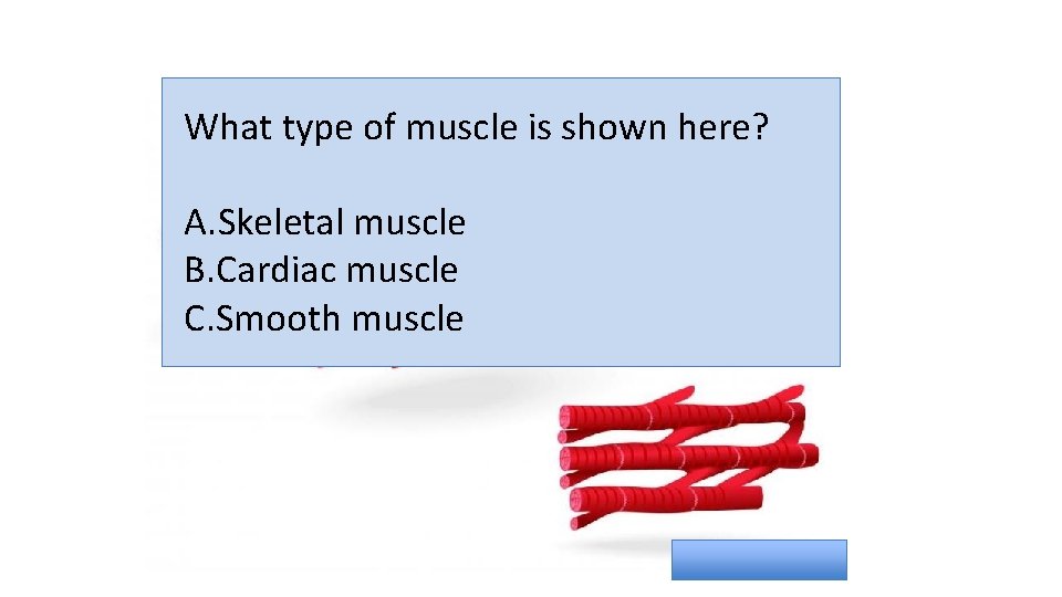 What type of muscle is shown here? A. Skeletal muscle B. Cardiac muscle C.