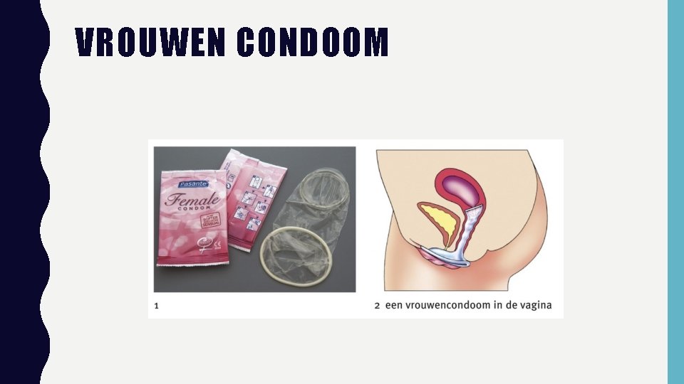 VROUWEN CONDOOM 