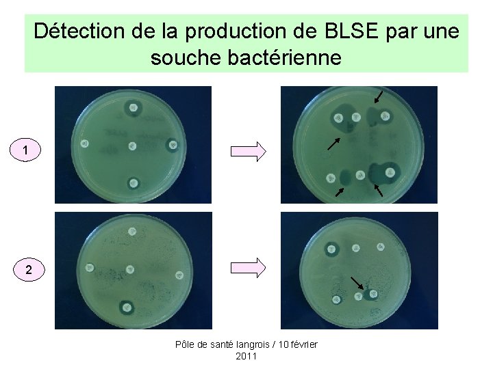 Détection de la production de BLSE par une souche bactérienne 1 2 Pôle de