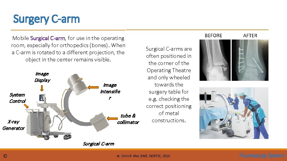 Surgery C-arm Mobile Surgical C-arm, for use in the operating room, especially for orthopedics Surgery C-arm Mobile Surgical C-arm, for use in the operating room, especially for orthopedics
