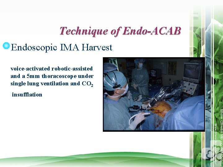 Technique of Endo-ACAB Endoscopic IMA Harvest voice-activated robotic-assisted and a 5 mm thoracoscope under
