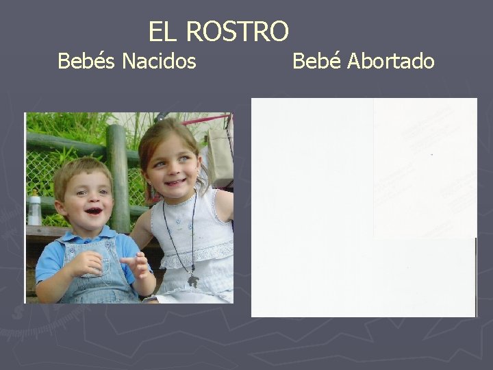 EL ROSTRO Bebés Nacidos Bebé Abortado 