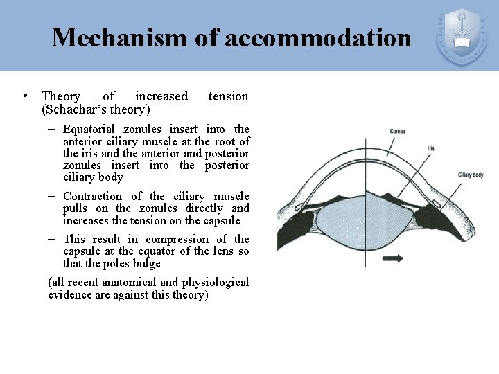 Mechanism of accommodation • Theory of increased (Schachar’s theory) tension – Equatorial zonules insert