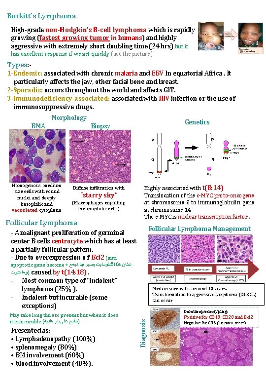 Burkitt’s Lymphoma High-grade non-Hodgkin's B-cell lymphoma which is rapidly growing (fastest growing tumor in