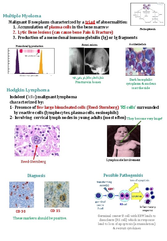 Multiple Myeloma Malignant B neoplasm characterized by a triad of abnormalities: 1. Accumulation of
