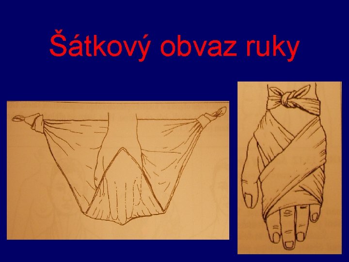 Šátkový obvaz ruky 