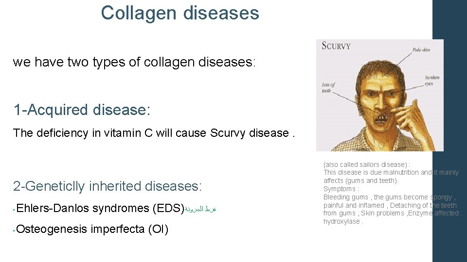 Collagen diseases we have two types of collagen diseases: 1 -Acquired disease: The deficiency