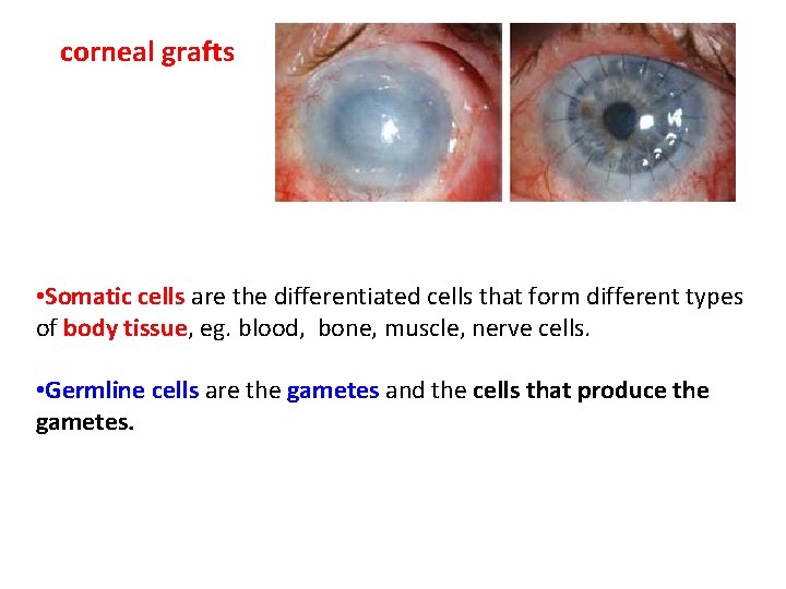 corneal grafts • Somatic cells are the differentiated cells that form different types of