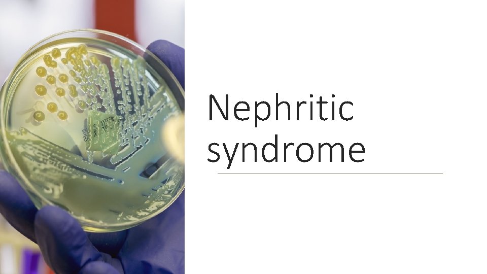 Nephritic syndrome 