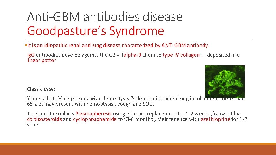 Anti-GBM antibodies disease Goodpasture’s Syndrome §It is an idiopathic renal and lung disease characterized