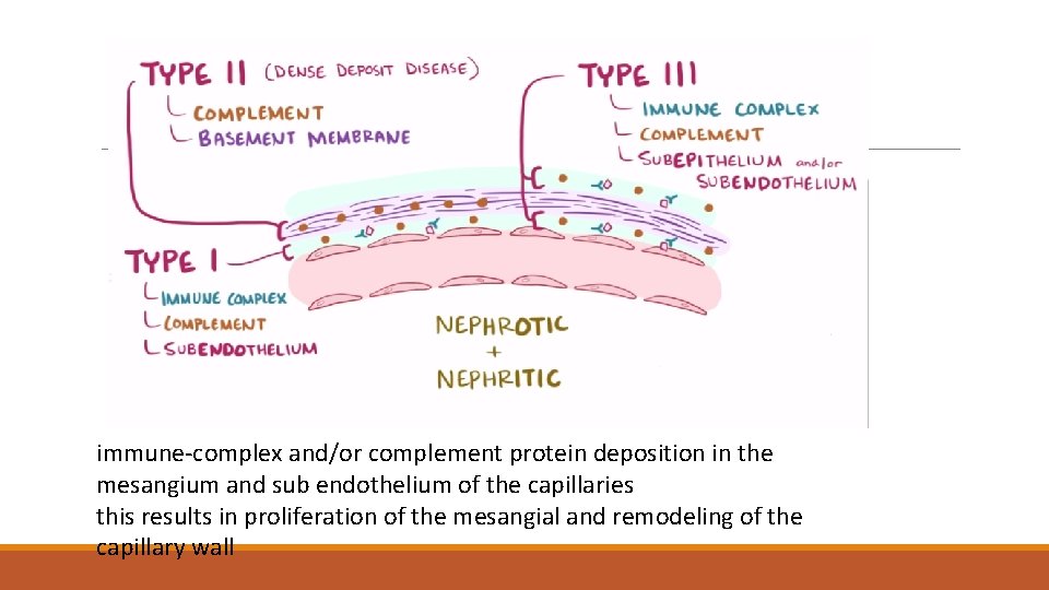 immune-complex and/or complement protein deposition in the mesangium and sub endothelium of the capillaries