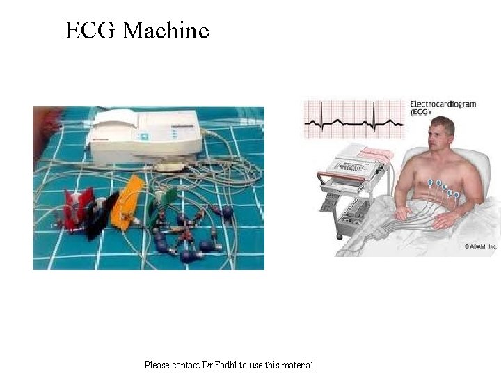 ECG Machine Please contact Dr Fadhl to use this material 