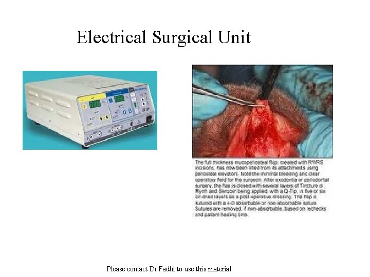 Electrical Surgical Unit Please contact Dr Fadhl to use this material 