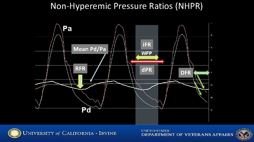 Non-Hyperemic Pressure Ratios (NHPR) Pa Mean Pd/Pa RFR Pd i. FR WFP d. PR