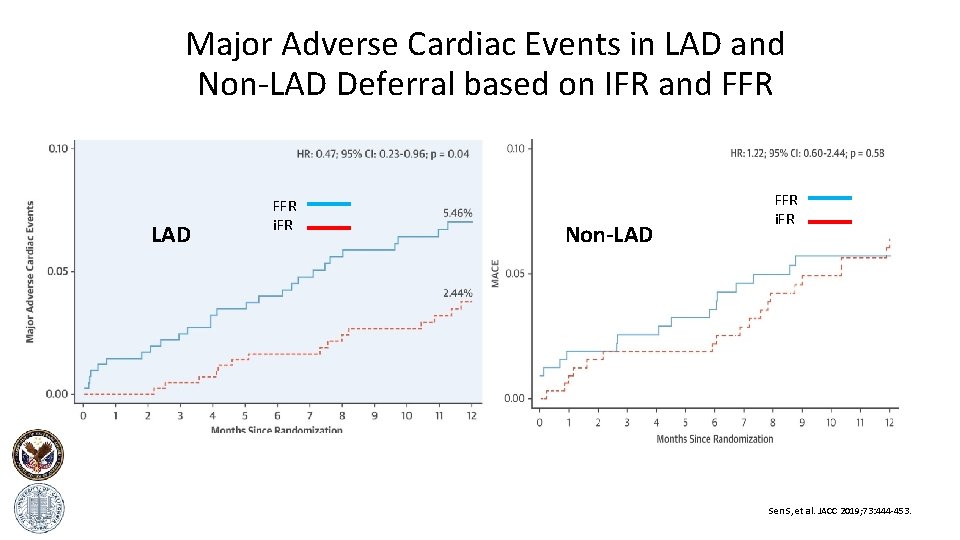 Major Adverse Cardiac Events in LAD and Non-LAD Deferral based on IFR and FFR