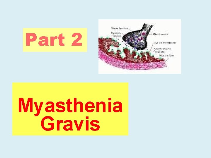 Part 2 Myasthenia Gravis 