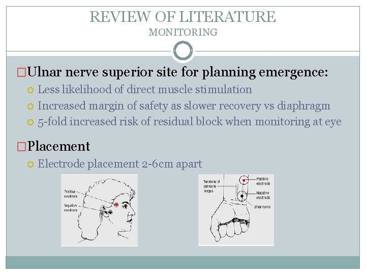 REVIEW OF LITERATURE MONITORING �Ulnar nerve superior site for planning emergence: Less likelihood of
