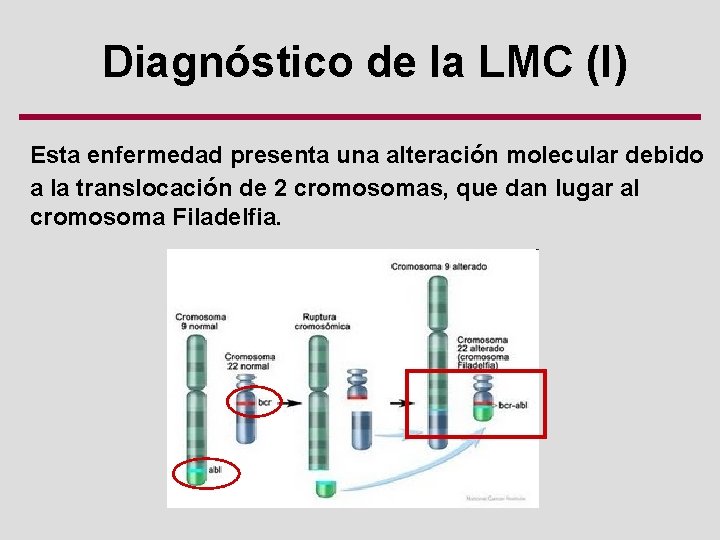 Diagnóstico de la LMC (I) Esta enfermedad presenta una alteración molecular debido a la