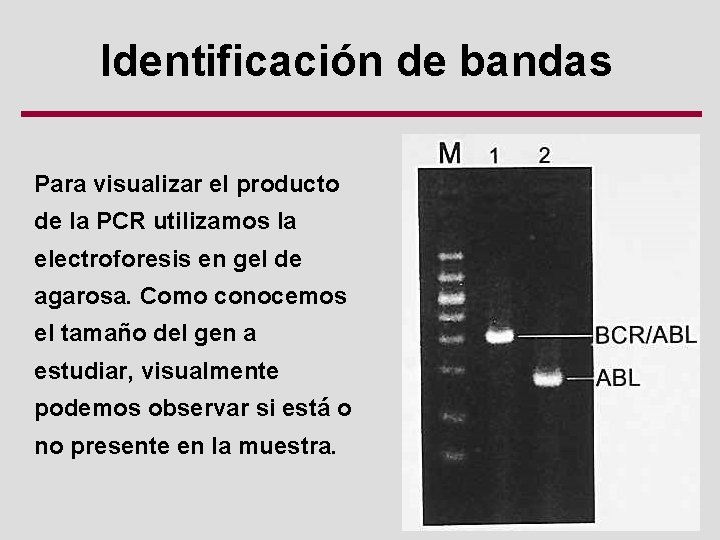 Identificación de bandas Para visualizar el producto de la PCR utilizamos la electroforesis en