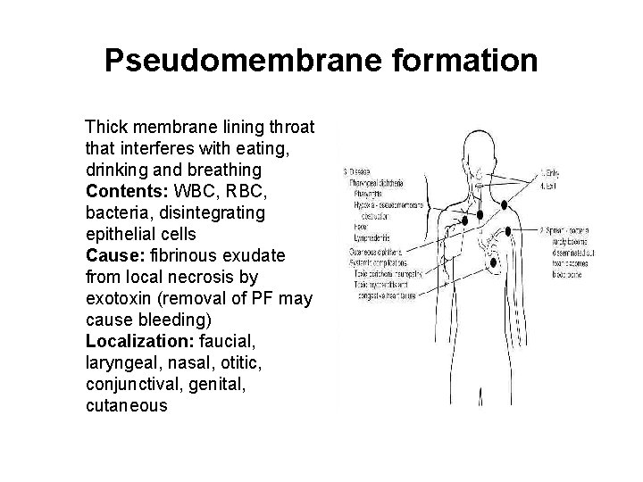 Pseudomembrane formation Thick membrane lining throat that interferes with eating, drinking and breathing Contents: