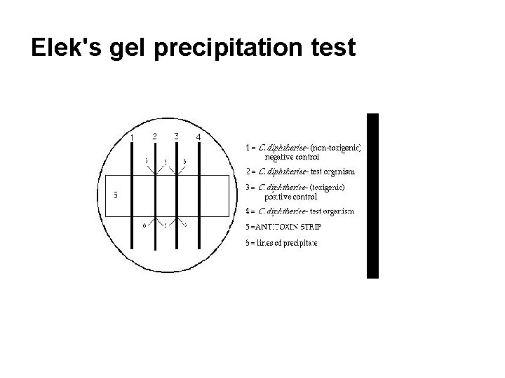 Elek's gel precipitation test 