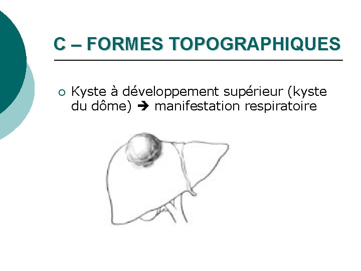 C – FORMES TOPOGRAPHIQUES ¡ Kyste à développement supérieur (kyste du dôme) manifestation respiratoire