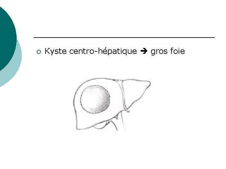 ¡ Kyste centro-hépatique gros foie 