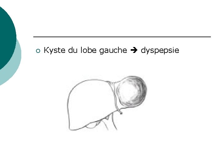 ¡ Kyste du lobe gauche dyspepsie 