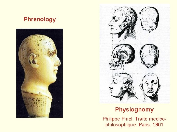 Phrenology Physiognomy Philippe Pinel. Traite medicophilosophique. Paris. 1801 