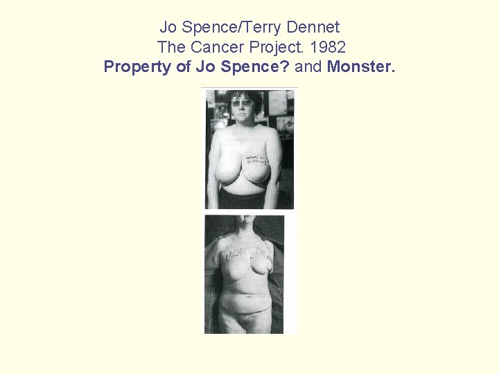 Jo Spence/Terry Dennet The Cancer Project. 1982 Property of Jo Spence? and Monster. 