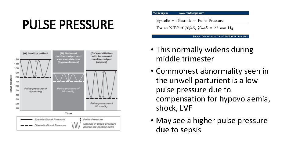 PULSE PRESSURE • This normally widens during middle trimester • Commonest abnormality seen in