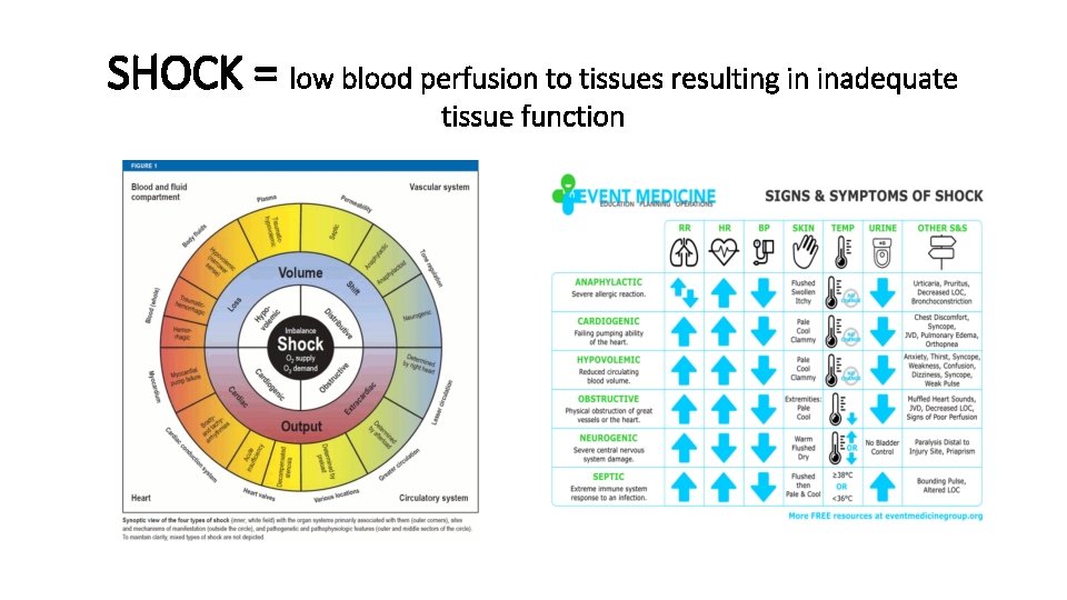 SHOCK = low blood perfusion to tissues resulting in inadequate tissue function 