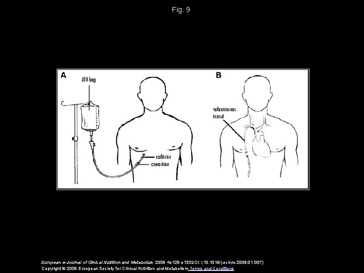 Fig. 9 European e-Journal of Clinical Nutrition and Metabolism 2009 4 e 128 -e