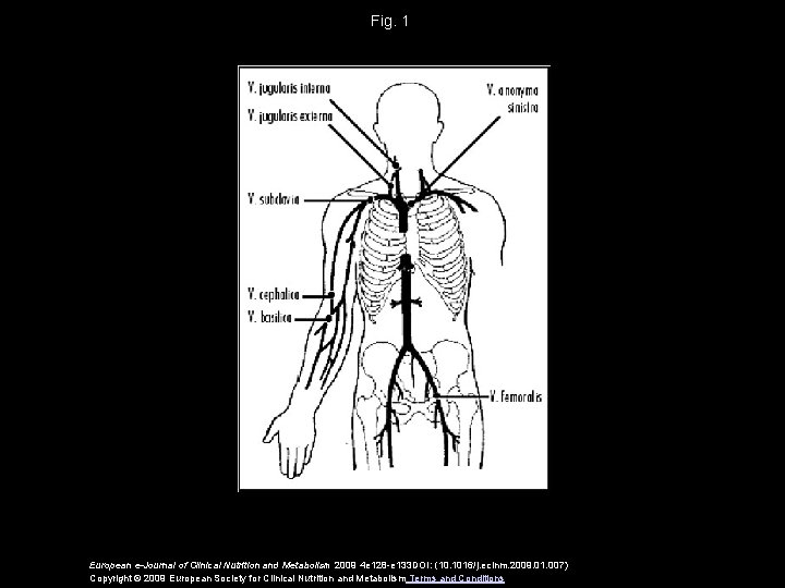 Fig. 1 European e-Journal of Clinical Nutrition and Metabolism 2009 4 e 128 -e