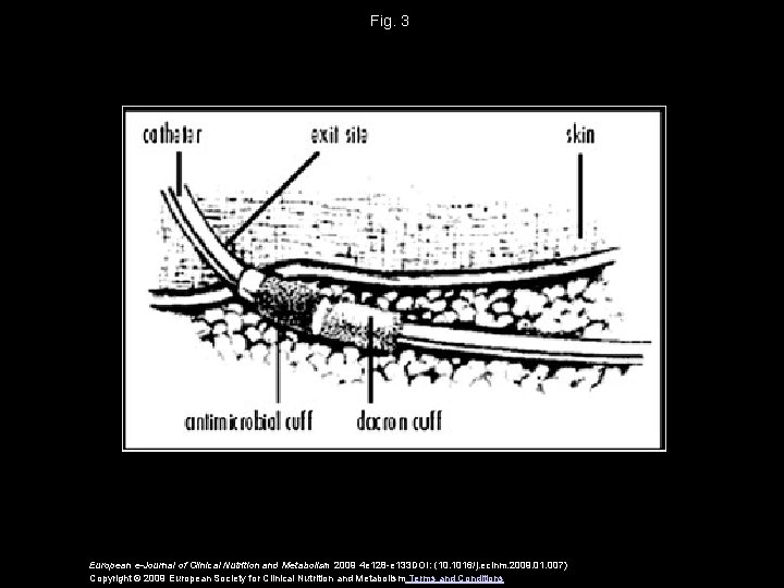 Fig. 3 European e-Journal of Clinical Nutrition and Metabolism 2009 4 e 128 -e