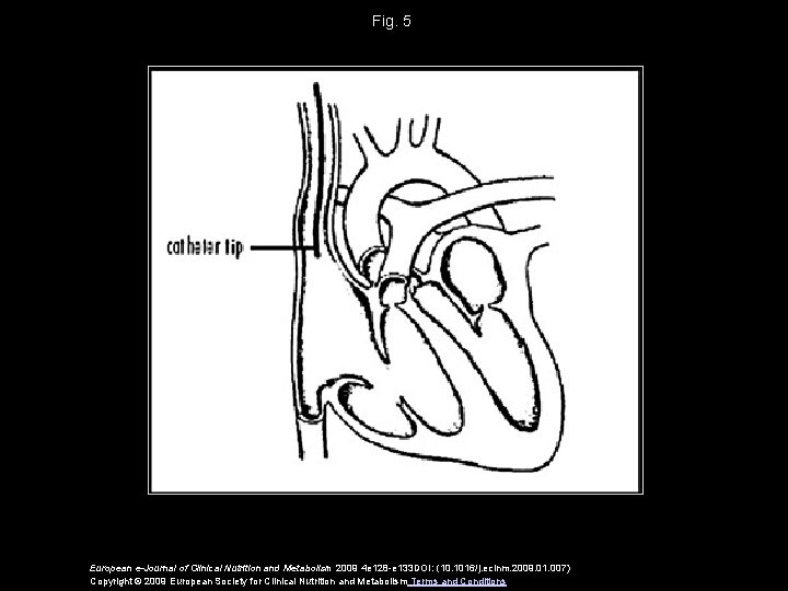 Fig. 5 European e-Journal of Clinical Nutrition and Metabolism 2009 4 e 128 -e