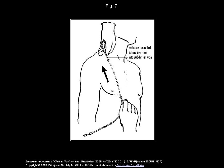 Fig. 7 European e-Journal of Clinical Nutrition and Metabolism 2009 4 e 128 -e