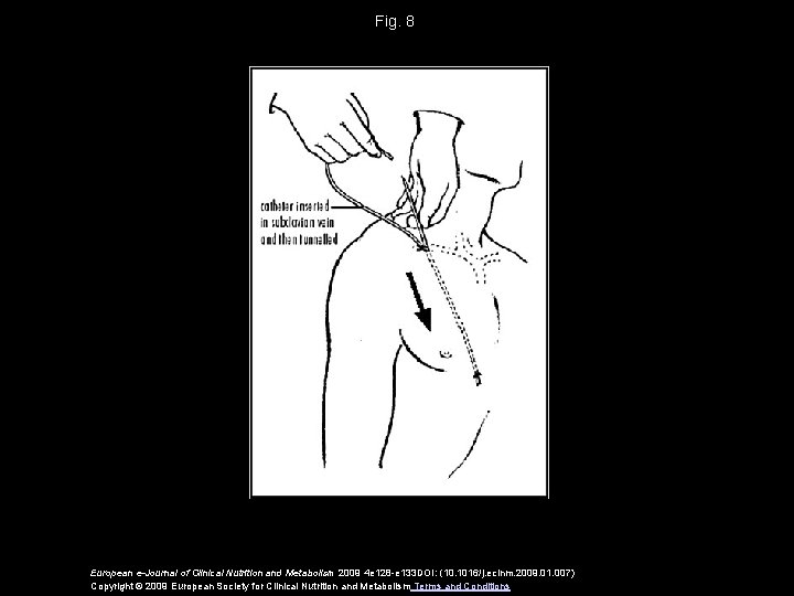 Fig. 8 European e-Journal of Clinical Nutrition and Metabolism 2009 4 e 128 -e