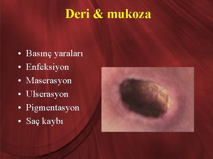 Deri & mukoza • • • Basınç yaraları Enfeksiyon Maserasyon Ulserasyon Pigmentasyon Saç kaybı