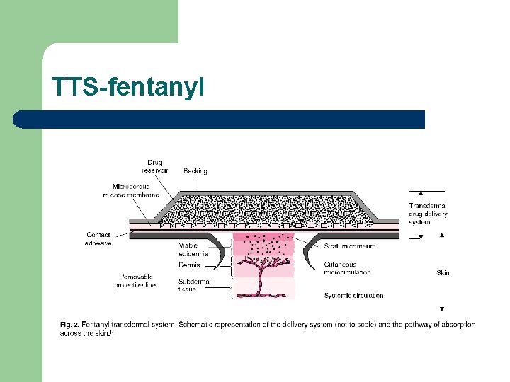 TTS-fentanyl 