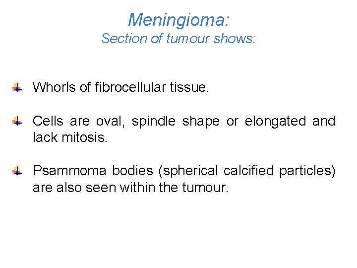 Meningioma: Section of tumour shows: Whorls of fibrocellular tissue. Cells are oval, spindle shape