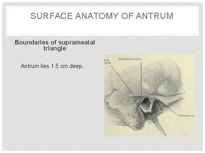 SURFACE ANATOMY OF ANTRUM Boundaries of suprameatal triangle Antrum lies 1. 5 cm deep.