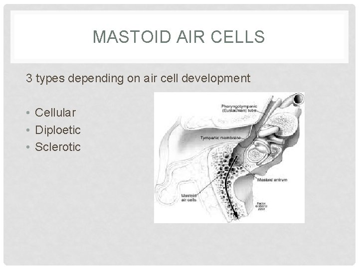 MASTOID AIR CELLS 3 types depending on air cell development • Cellular • Diploetic