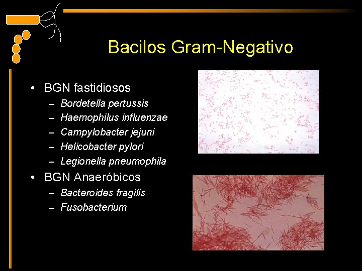 Bacilos Gram-Negativo • BGN fastidiosos – – – Bordetella pertussis Haemophilus influenzae Campylobacter jejuni